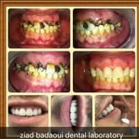 Ziad Al Badaoui Dental Laboratory logo